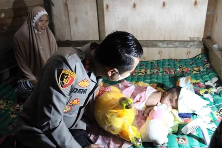 Kapolres Labuhanbatu Kunjungi Bayi Penderita Hidrosefalus di Tanjungmedan
