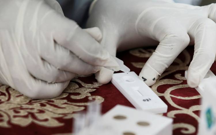 Harga Rapid Test Antigen Turun Jadi Rp 99 Ribu, Luar Jawa Rp 109 Ribu