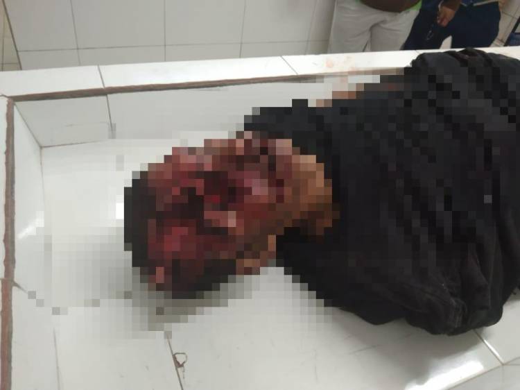 Warga Desa Rakut Besi Tewas Lakalantas di Saribudolok