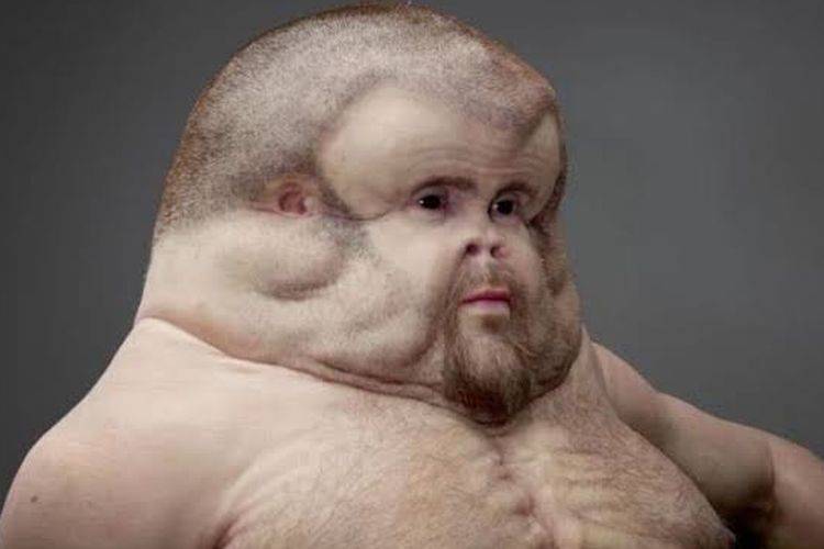 Tim di Australia &ldquo;Ciptakan&rdquo; Manusia Mutan yang Bisa Bertahan dari Kecelakaan Maut