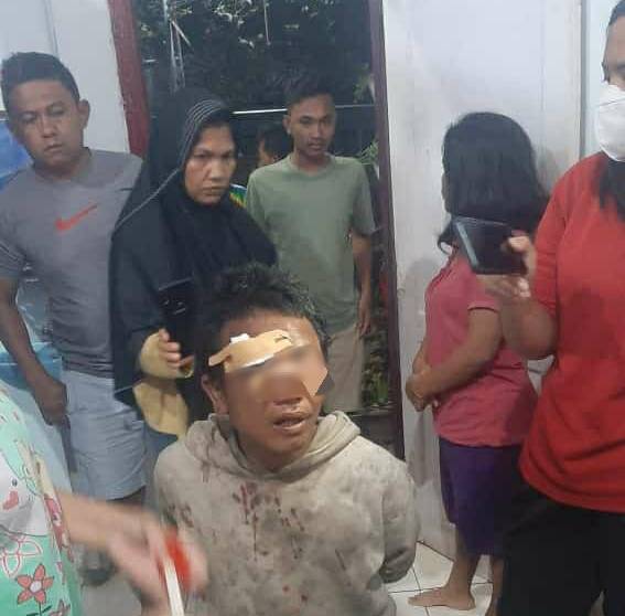 Pria Gelandangan Dicurigai Culik Anak, Luka-luka Diamuk Massa