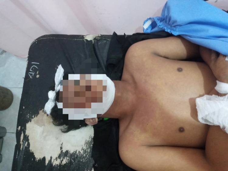 Korban Tabrak Lari, Pengendara Sepeda Motor Tewas di Tanjungbalai