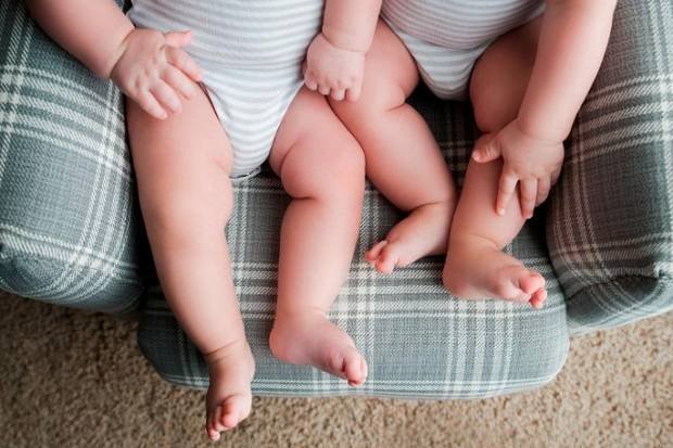 Bayi Kembar Siam Asal Batubara Meninggal Dunia di RS Adam Malik