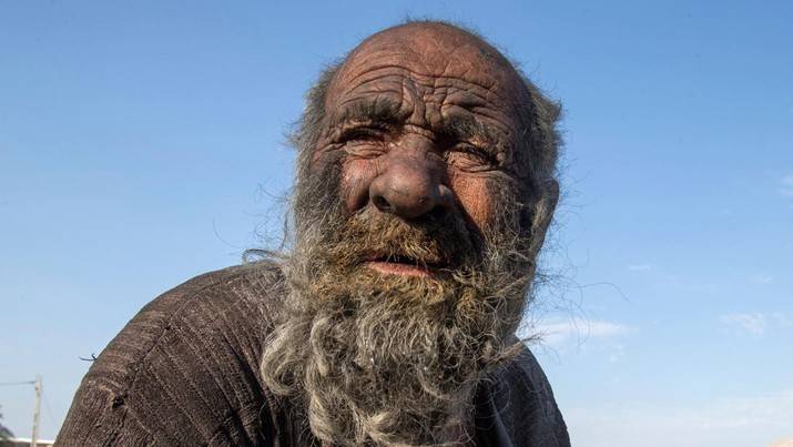 Kisah Pria Terjorok di Dunia yang Tidak Mandi Selama 60 Tahun