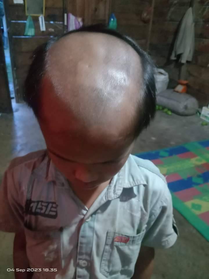 Guru Botaki Siswa SMPN 1 Sianjurmula-mula Viral, Kadisdikpora Samosir: Wali Murid dan Guru Sudah Damai