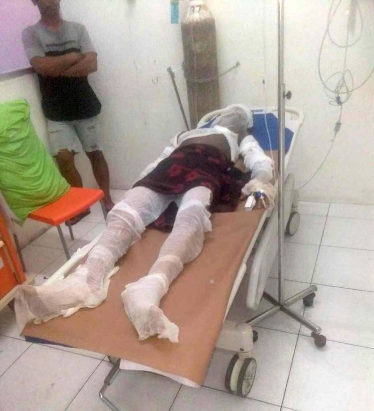 Dituduh Curi HP Tanpa Ada Bukti, Deni Dibakar Hidup-hidup di Perumnas Mandala