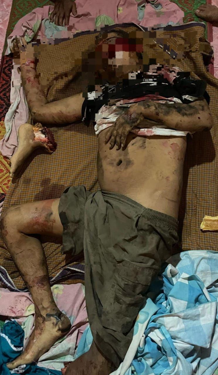 Muhammad Indra Warga Tebingtinggi Tewas Tertabrak Kereta Api