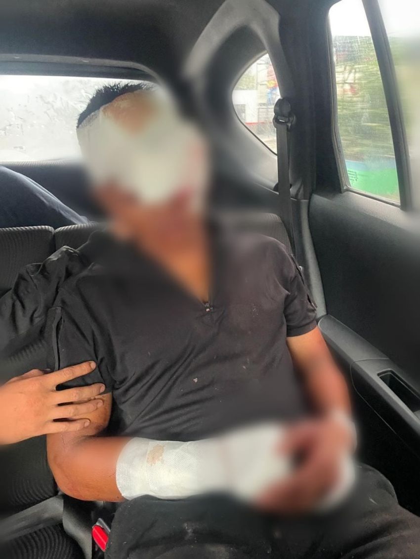 Anggota TNI yang Dibacok Geng Motor di Medan Alami Kebutaan