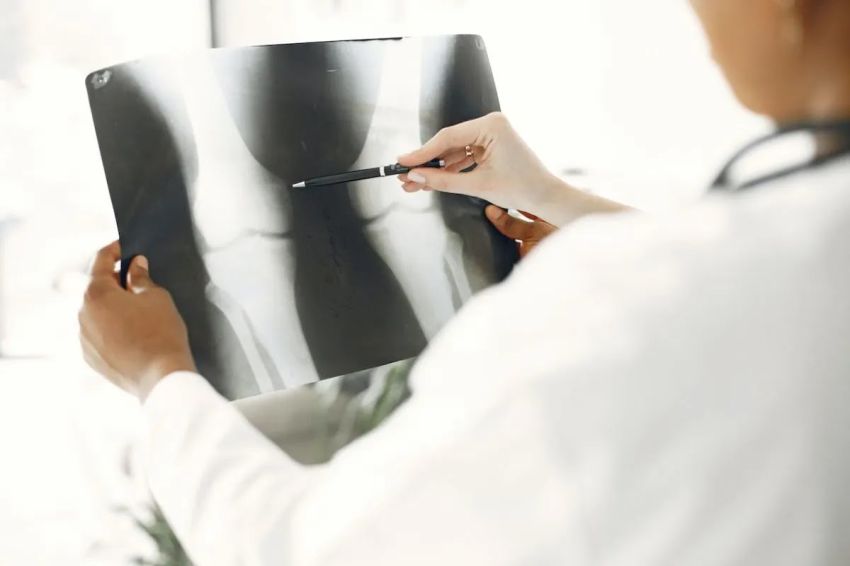 Pakar Ungkap Cara Cegah Osteoporosis dari Usia Muda