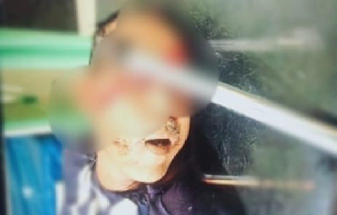 Dikapak Tetangga, Jhon Ambarita Tewas di Depan Rumah Pelaku