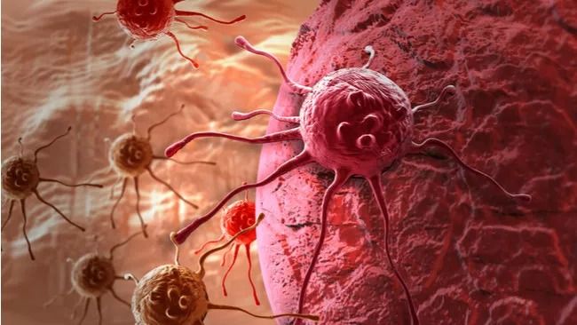 Riset Ungkap Sel Kanker Dapat Bersembunyi dan Kembali Menyerang