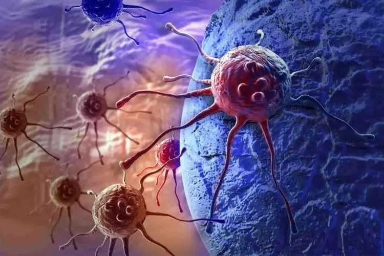 Risiko Kanker Lebih Tinggi pada Wanita di Usia Muda Dibandingkan Pria