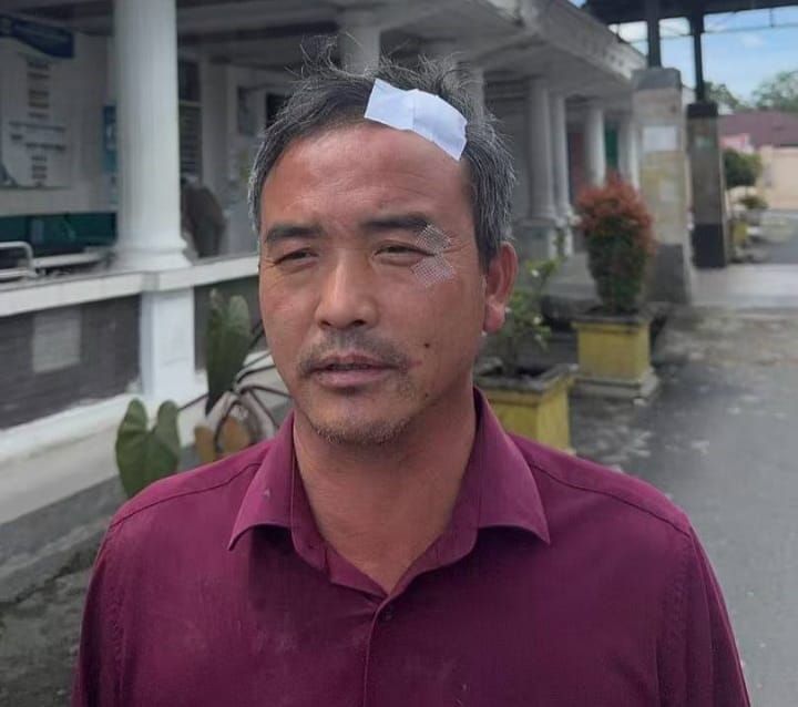 Diduga Dianiaya, Chen WNA Bekerja di Areal PT DPM Buat Laporan ke Polres Dairi