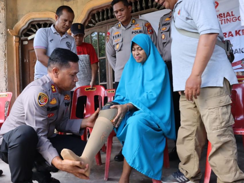 Sambut HUT Bhayangkara, Polres Tebingtinggi Berikan Kaki Palsu dan SIM Gratis kepada Penyandang Disabilitas