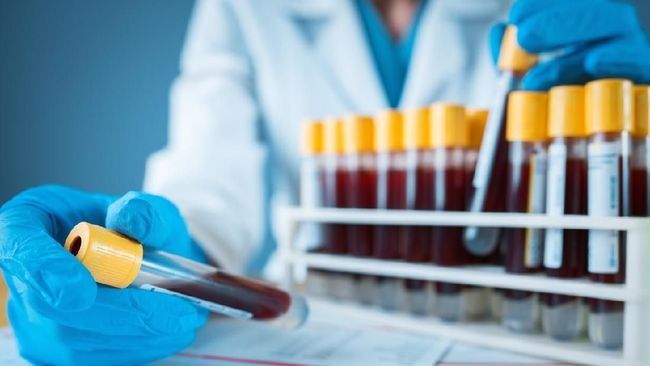 Hanya 50 Orang yang Punya Golden Blood, Apa Istimewanya?