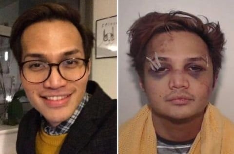 Orangtua Reynhard Sinaga Ajukan Permohonan Pemulangan, Yusril Terima Surat Resminya