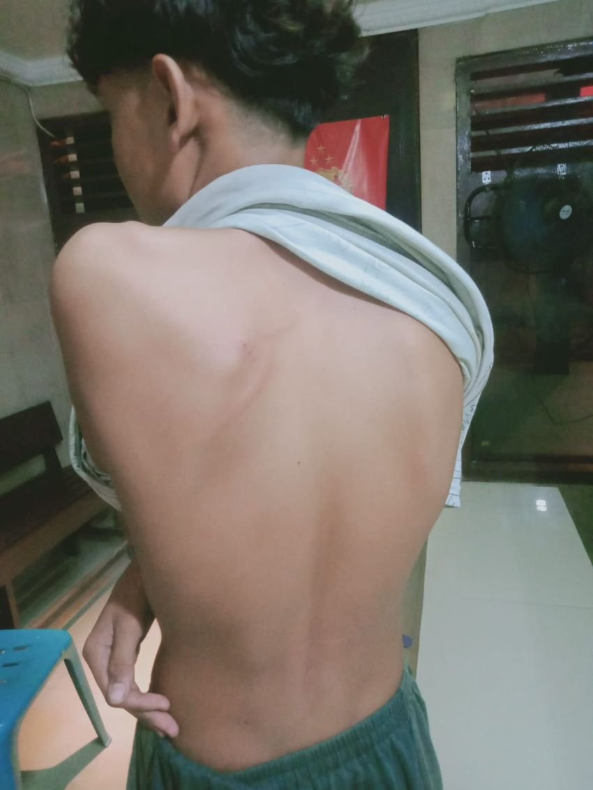 Angkut Bantuan Korban Banjir,  Abdul Syahputra Dianiaya Sejumlah Pria