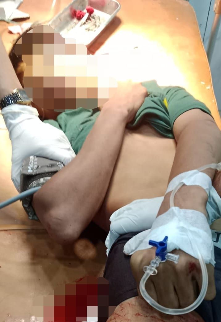 Seorang Remaja Meninggal Dunia Akibat Tawuran di Sibolga