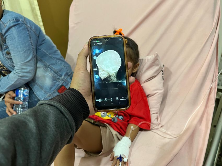 Bocah Korban Peluru Nyasar Dirawat di RS Pirngadi Medan