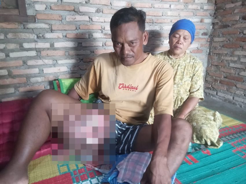 Derita Tumor 3 Kg, Rudi Nainggolan Harapkan Uluran Tangan dari Pemkab Asahan