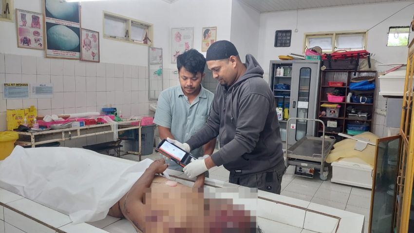 Gunakan Teknologi Mambis, Tim Inafis dan Unit Gakkum Polres Simalungun Identifikasi Korban Laka