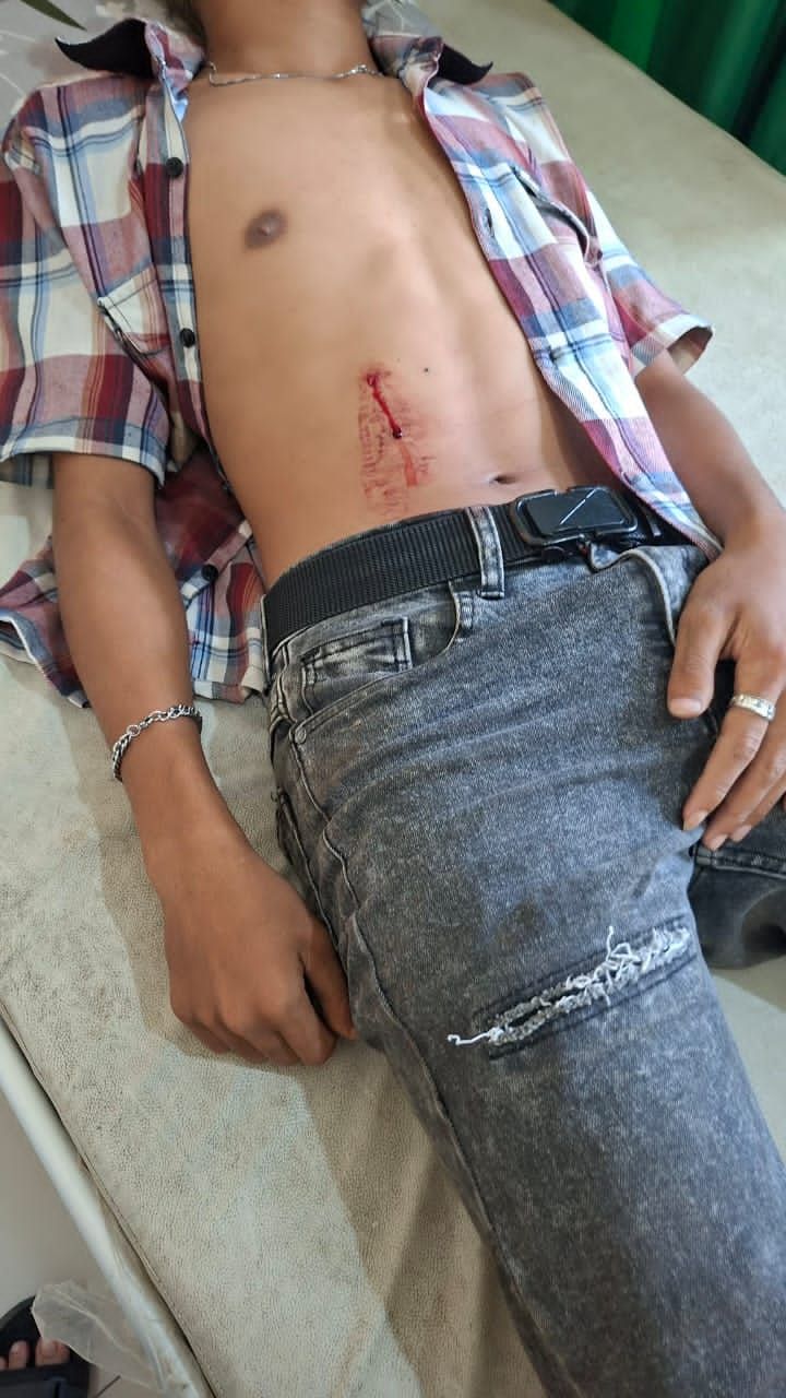 DPRD SU Minta Polda Sumut Tangkap Pelaku Penembakan Anak di Bawah Umur di Langkat