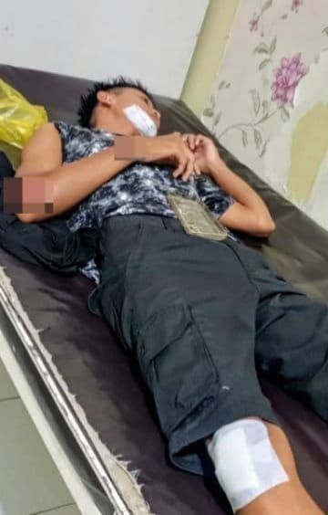 Suzuki Ertiga Tabrak Motor di Jalinsum Batubara, Satu Orang Luka Serius