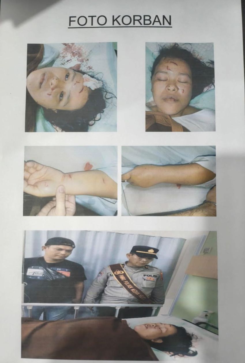 Tetangga Tikam IRT di Helvetia, Dipicu Debu Sapu dan Bau Kandang Babi