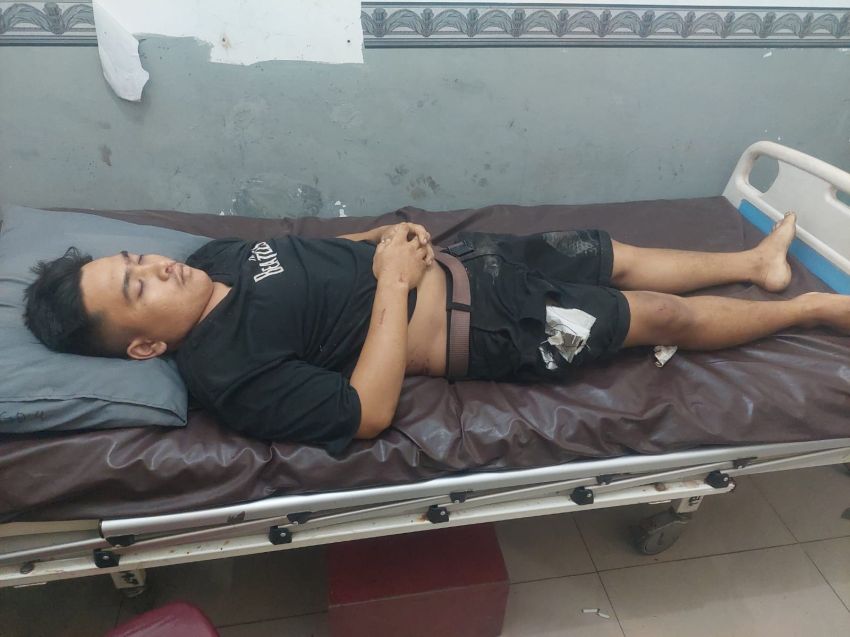 Sepeda Motor Laga Kambing dengan Mobil Hardtop, Rio Elkanna Sembiring Tewas di Tigabinanga