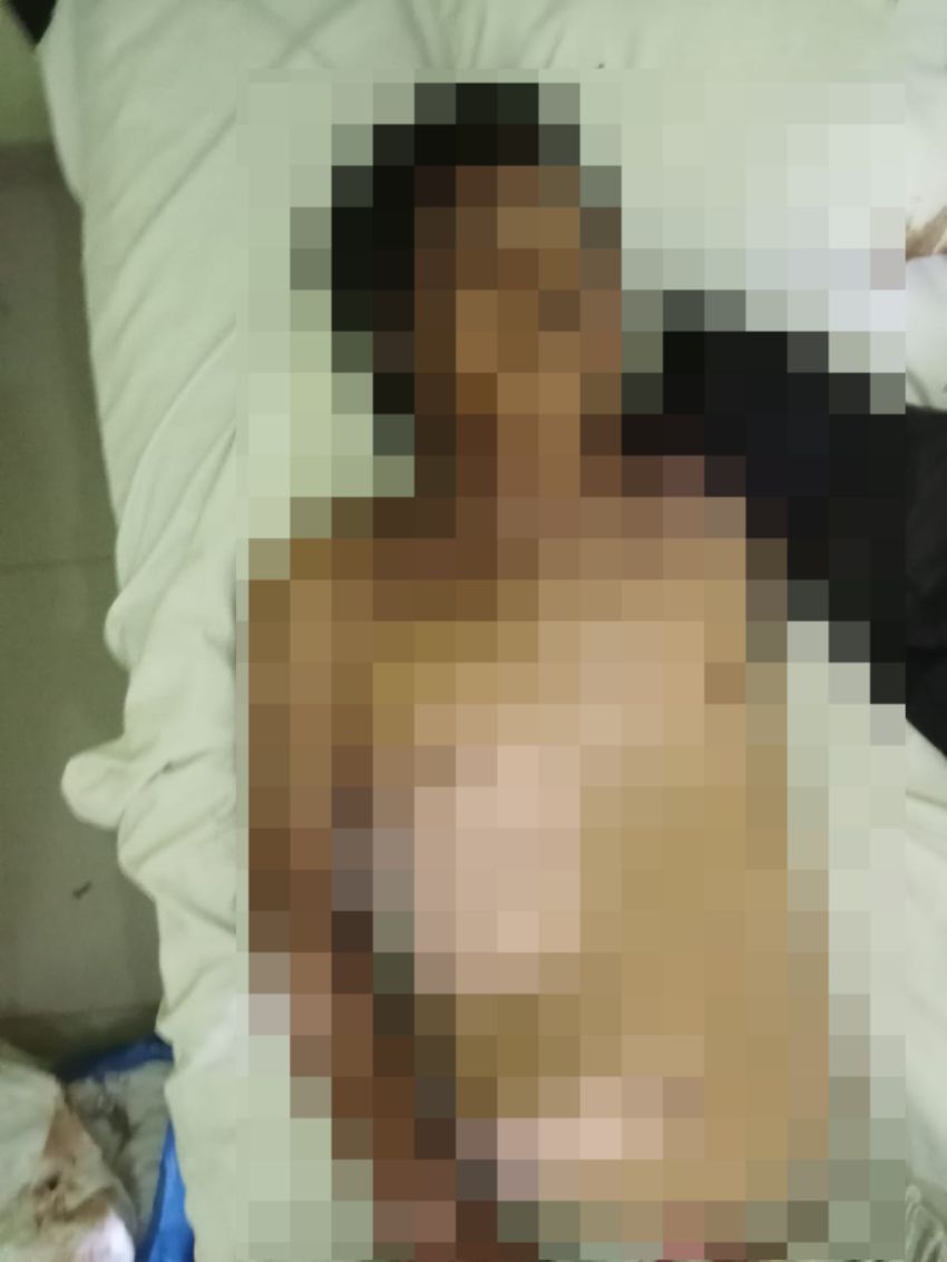 Pria 41 Tahun Ditemukan Tewas di Kamar Hotel Parapat