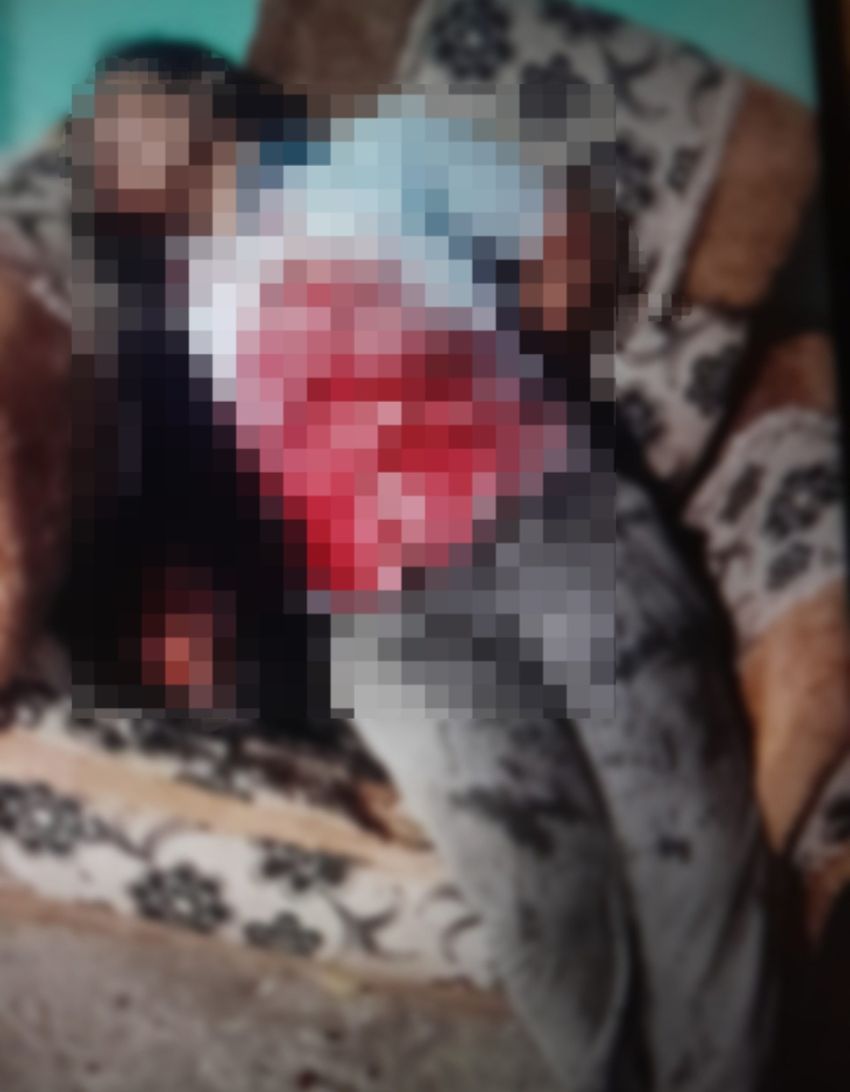 Seorang Wanita Tewas Diduga Ditikam di Jalan Kutilang Tebingtinggi