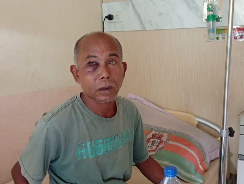 Tidak Terima Dikeroyok, Pria 59 Tahun di Siantar Lapor Polisi
