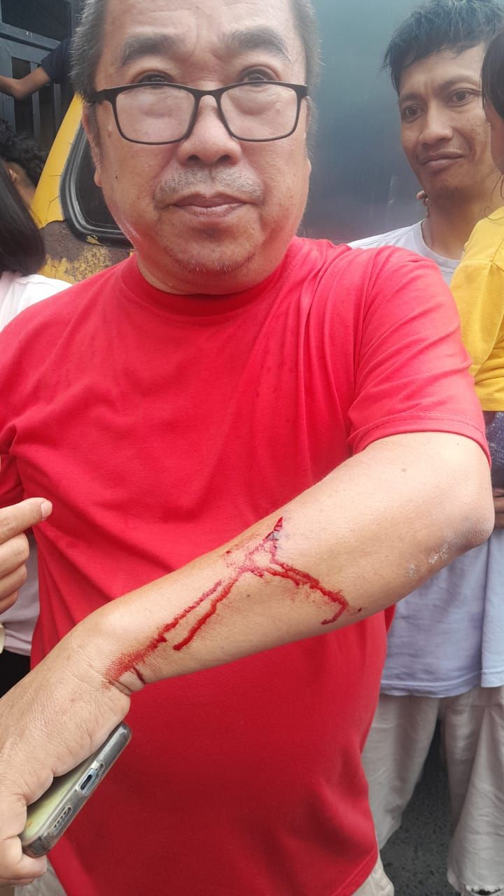 Terduga Maling Besi Bersenjata Kapak Diamuk Warga di Marelan