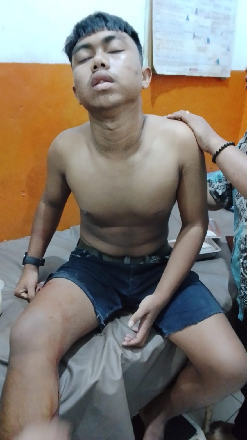 Remaja 16 Tahun Korban Salah Sasaran, Dibacok Pelaku Tawuran