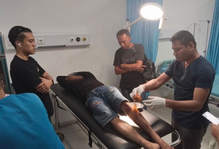 Beraksi di KIM 5, Polres  Belawan Tembak Bandit Jalanan Bersajam