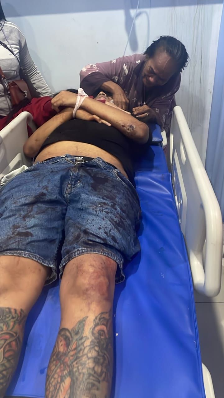 Diduga Dipicu Bentrok Ormas, Pengurus PP Deli Serdang Tewas Ditembak OTK di Tanjungmorawa